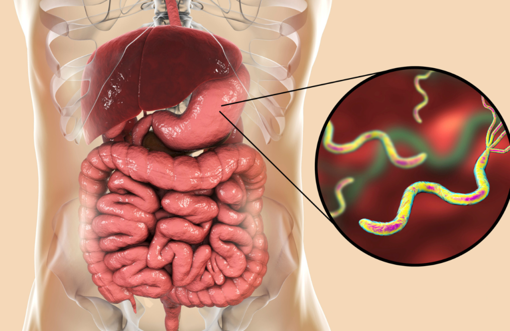 PAIN ABDOMEN AND H PYLORI treatment in India