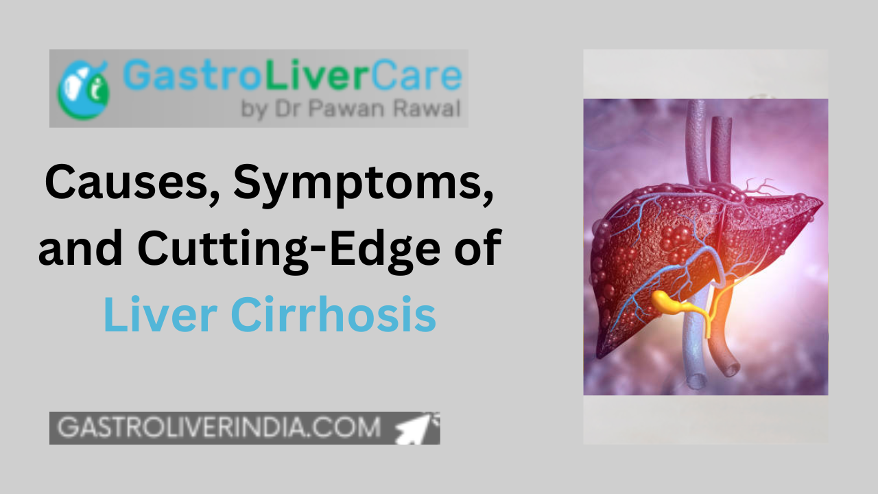 Causes, Symptoms, and Cutting-Edge of Liver Cirrhosis