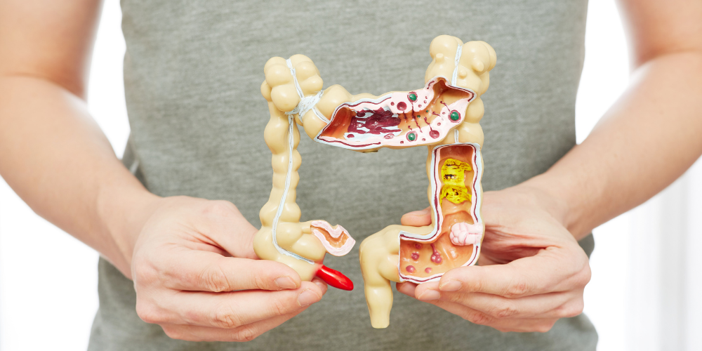 Constipation Side Effects Constipation Side Effects