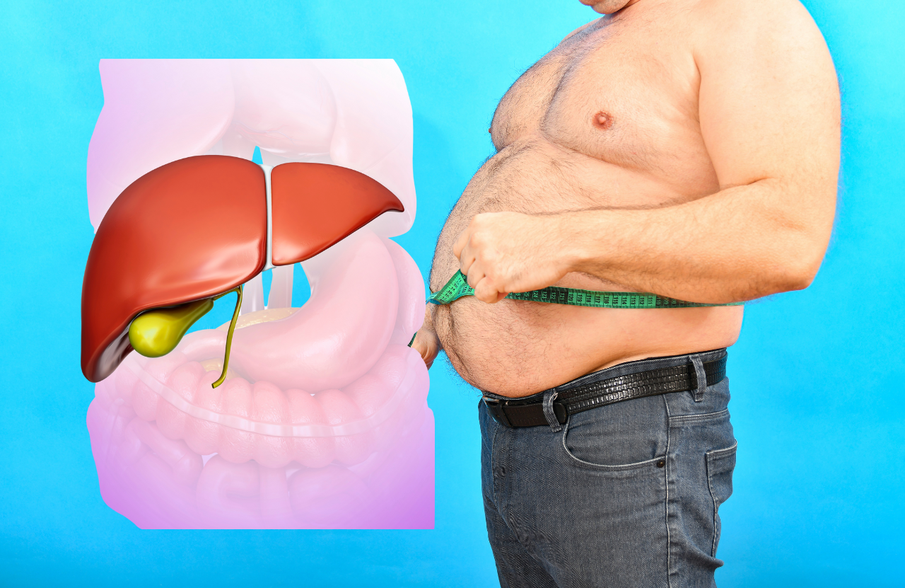 Obesity and Liver Health Obesity and Liver Health