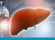 Grade 1 Fatty Liver