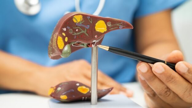 Liver Transplant Cost in Gurgaon
